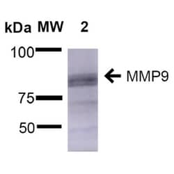 MMP-9 Antibody (S51-82), Novus Biologicals 100ug; Unlabeled:Antibodies,